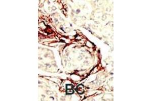 Immunohistochemistry (IHC) image for anti-serine/threonine Kinase 11 (STK11) antibody (ABIN3003070) (LKB1 抗体)