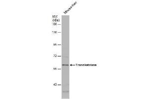 WB Image Mouse tissue extract (50 μg) was separated by 7. (TKT 抗体)
