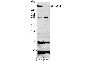 anti-FAT Tumor Suppressor Homolog 4 (FAT4) (AA 4931-4981) antibody