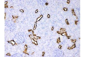 Cytokeratin 18 was detected in paraffin-embedded sections of rat kidney tissues using rabbit anti- Cytokeratin 18 Antigen Affinity purified polyclonal antibody (Catalog # ) at 1 µg/mL. (Cytokeratin 18 抗体  (AA 204-430))