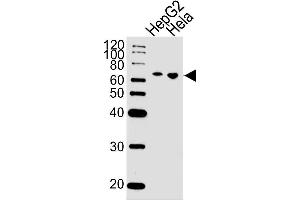 Lane 1: HepG2 Cell lysates, Lane 2: HeLa Cell lysates, probed with NLK (1146CT24. (Nemo-Like Kinase 抗体)