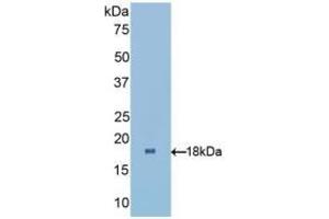 Detection of Recombinant RBP1, Human using Polyclonal Antibody to Retinol Binding Protein 1, Cellular (RBP1) (RBP1 抗体  (AA 2-135))