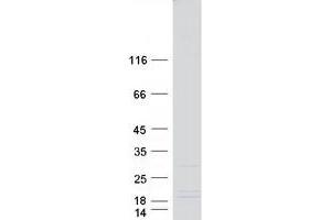 Western Blotting (WB) image for DPY30 Domain Containing 1 (DYDC1) protein (Myc-DYKDDDDK Tag) (ABIN2719846)