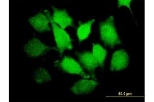 Immunofluorescence of purified MaxPab antibody to PLCXD1 on HeLa cell. (PLCXD1 抗体  (AA 1-323))