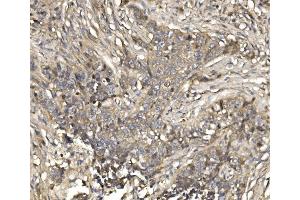 IHC analysis of EIF4EBP1 using anti-EIF4EBP1 antibody (ABIN7602881). (eIF4EBP1 抗体  (C-Term))