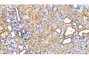 Detection of SQSTM1 in Human Kidney Tissue using Polyclonal Antibody to Sequestosome 1 (SQSTM1) (SQSTM1 抗体  (AA 136-400))