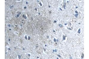 Immunohistochemistry (IHC) image for anti-Transforming Growth Factor, beta-Induced, 68kDa (TGFBI) (AA 423-632) antibody (ABIN7431149)