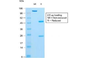 SDS-PAGE Analysis Purified Insulin Mouse Recombinant Monoclonal Antibody (rIRDN/805). (Recombinant Insulin 抗体)