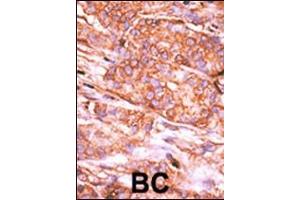 Immunohistochemistry (Paraffin-embedded Sections) (IHC (p)) image for anti-CTD (Carboxy-terminal Domain, RNA Polymerase II, Polypeptide A) Small Phosphatase 2 (CTDSP2) (AA 12-42), (N-Term) antibody (ABIN392885)