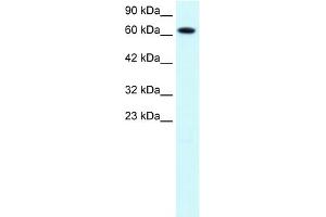 WB Suggested Anti-PIAS3 Antibody Titration:  1. (PIAS3 抗体  (C-Term))