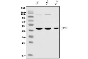 Western blot analysis of Cbx8 using anti-Cbx8 antibody (ABIN7599340).