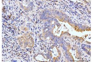 IHC analysis of Golgin 97/GOLGA1 using anti-Golgin 97/GOLGA1 antibody (ABIN7599539).