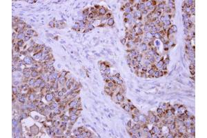 IHC-P Image TUFM antibody detects TUFM protein at mitochondria on H441 xenograft by immunohistochemical analysis. (TUFM 抗体)
