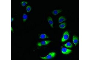 Immunofluorescent analysis of A549 cells using ABIN7154384 at dilution of 1:100 and Alexa Fluor 488-congugated AffiniPure Goat Anti-Rabbit IgG(H+L) (GRAMD1B 抗体  (AA 235-504))