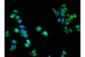 Immunofluorescent analysis of HepG2 cells using ABIN7169080 at dilution of 1:100 and Alexa Fluor 488-congugated AffiniPure Goat Anti-Rabbit IgG(H+L) (PKN2 抗体  (AA 925-969))