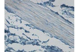 Immunohistochemical staining of formalin-fixed paraffin-embedded human stomach tissue showing cytoplasmic staining with CNN1 polyclonal antibody  at 1 : 100 dilution. (CNN1 抗体  (AA 150-250))
