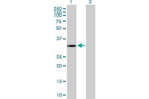 Western Blot analysis of ITPK1 expression in transfected 293T cell line by ITPK1 MaxPab polyclonal antibody. (ITPK1 抗体  (AA 1-314))