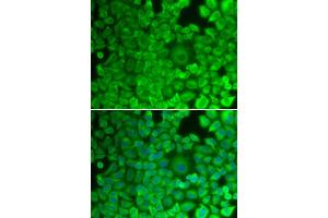 Immunofluorescence analysis of HeLa cells using GYS1 antibody (ABIN5971351). (Glycogen Synthase 1 抗体)