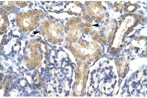Immunohistochemistry (IHC) image for anti-Acyl-CoA Synthetase Long-Chain Family Member 1 (Acsl1) (C-Term) antibody (ABIN2777590)