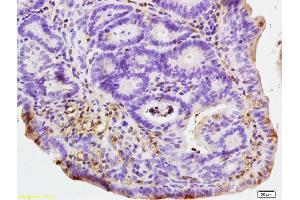Formalin-fixed and paraffin embedded rat colitis labeled with Rabbit Anti NALP4 Polyclonal Antibody, Unconjugated (ABIN872353) at 1:200 followed by conjugation to the secondary antibody and DAB staining (NLRP4 抗体  (AA 351-450))