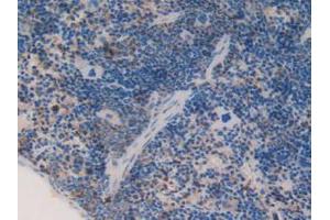 IHC-P analysis of Mouse Spleen Tissue, with DAB staining. (C1QA 抗体  (AA 23-245))