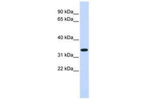 Image no. 1 for anti-Tripartite Motif Containing 14 (TRIM14) (AA 204-231) antibody (ABIN6740402) (TRIM14 抗体  (AA 204-231))