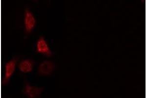 ABIN6275664 staining  HeLa cells by IF/ICC.