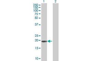 Lane 1: HEMK2 transfected lysate ( 20. (HEMK2 293T Cell Transient Overexpression Lysate(Denatured))