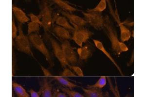 Immunofluorescence analysis of C6 cells using STUB1 Polyclonal Antibody at dilution of 1:100 (40x lens). (STUB1 抗体)