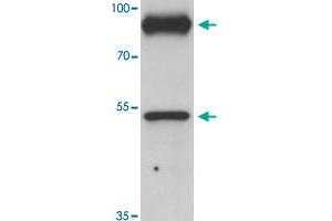 Western blot analysis of PRICKLE1 in human bladder tissue with PRICKLE1 polyclonal antibody  at 1 ug/mL. (PRICKLE1 抗体  (C-Term))