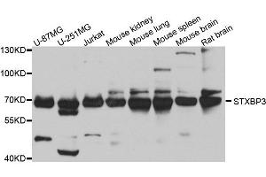 Western blot analysis of extracts of various cell lines, using STXBP3 antibody. (STXBP3 抗体  (AA 343-592))