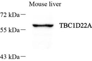 Western blot analysis of TBC1D22A (ABIN7075845) at dilution of 1: 800 (TBC1D22A 抗体)