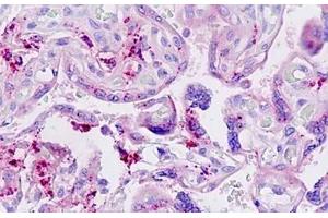 Human Placenta: Formalin-Fixed, Paraffin-Embedded (FFPE) (LGMN 抗体  (AA 83-112))