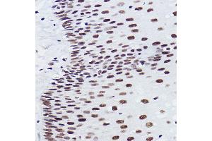 Immunohistochemistry of paraffin-embedded human esophageal using BRMS1 Rabbit mAb (ABIN7265928) at dilution of 1:100 (40x lens). (BRMS1 抗体)
