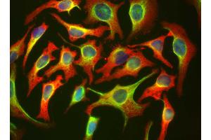 HeLa cells staining with HSBP1 antibody (red), and counterstained with chicken polyclonal antibody to Vimentin (green) and DNA (blue).