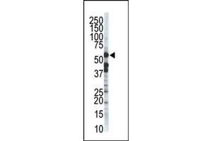 Image no. 1 for anti-Zinc Metalloproteinase, Ste24 (Zmpste24) (C-Term) antibody (ABIN357708) (ZMPSTE24 抗体  (C-Term))