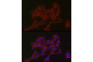 Immunofluorescence (IF) image for anti-Actin Related Protein 2/3 Complex, Subunit 2, 34kDa (ARPC2) antibody (ABIN7265385)