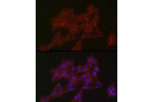 Immunofluorescence analysis of PC-12 cells using  Rabbit mAb (ABIN7265385) at dilution of 1:100 (40x lens). (ARPC2 抗体)