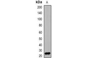 Western blot analysis of PSMD10 expression in SW620 (A) whole cell lysates. (PSMD10 抗体)
