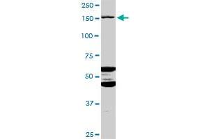 Western Blotting (WB) image for anti-ATP-Binding Cassette, Sub-Family C (CFTR/MRP), Member 11 (ABCC11) (AA 1-553) antibody (ABIN529876)