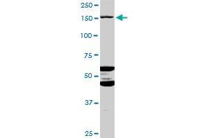 ABCC11 MaxPab polyclonal antibody. (ABCC11 抗体  (AA 1-553))