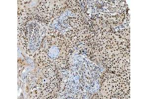 IHC analysis of RING2/RING1B/RNF2 using anti-RING2/RING1B/RNF2 antibody (ABIN7599286).