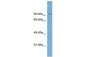 WB Suggested Anti-OSBPL1A Antibody Titration:  0. (OSBPL1A 抗体  (Middle Region))