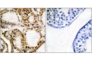 Immunohistochemistry analysis of paraffin-embedded human testis, using Retinoblastoma (Phospho-Thr821) Antibody. (Retinoblastoma Protein (Rb) 抗体  (pThr821))
