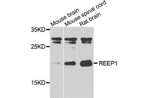 Western blot analysis of extracts of various tissues, using REEP1 antibody. (Receptor Accessory Protein 1 抗体)