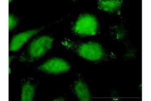 Immunofluorescence of purified MaxPab antibody to CCL27 on HeLa cell. (CCL27 抗体  (AA 1-112))