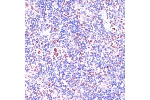 Immunohistochemistry of paraffin-embedded rat spleen using KDM1 antibody (ABIN7268323) at dilution of 1:100 (40x lens). (LSD1 抗体  (AA 130-380))