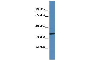 Western Blotting (WB) image for anti-Golgin A6 Family-Like 2 (GOLGA6L2) (Middle Region) antibody (ABIN2788891) (GOLGA6L2 抗体  (Middle Region))