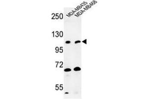 Western blot analysis of EXTL3 Antibody (N-term) in MDA-MB435, MDA-MB468 cell line lysates (35ug/lane). (EXTL3 抗体  (N-Term))