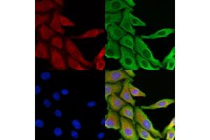 ABIN6266031 and ABIN6269398 staining HepG2 cells by IF/ICC. (WNK1 抗体  (N-Term))